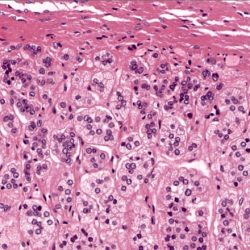 Adrenal medulla cortex glands histology gland hyperplasia microscopio congenital microscope endocrine glomerulosa labelled reticularis surrene ghiandola surrenale fasciculata vein ghiandole