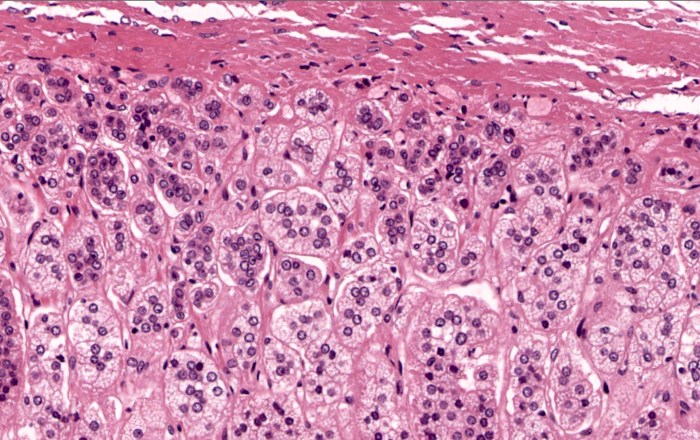 Adrenal medulla cortex glands histology gland hyperplasia microscopio congenital microscope endocrine glomerulosa labelled reticularis surrene ghiandola surrenale fasciculata vein ghiandole